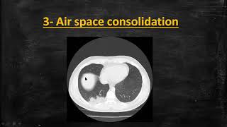 Full COVID-19 CT chest radiology part 1 Update