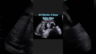 23 Weeks 3 Days Baby Face