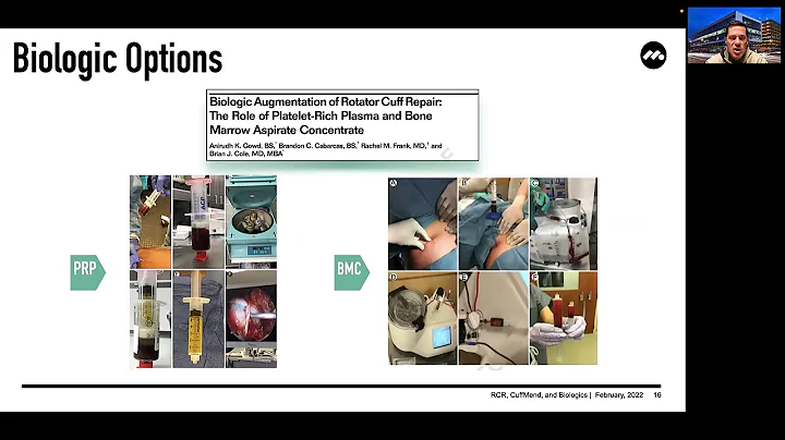 Biologic Augmentation of Rotator Cuff Tears