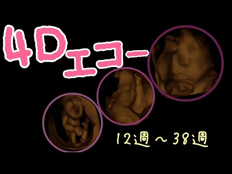 胎児4dエコー 12週 38週 娘編 Youtube