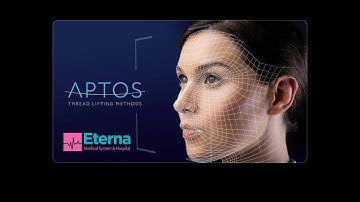 Aptos niti deo 1 (Aptos threads, part 1)