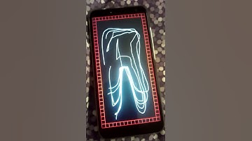 Oukitel C8 touch screen problem