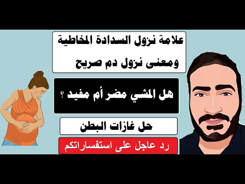 فيديو: هل يمكن أن تكون سدادة المخاط لديك خضراء مصفرة؟