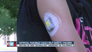 "Artificial pancreas" could help diabetic children