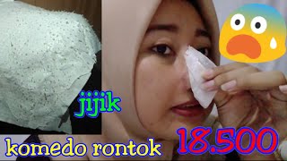 PEMBASMI KOMEDO | BASMI KOMEDO DALAM 15 MENIT | BERSIH CABUT KOMEDO (GEL HUT MUN WHITE)