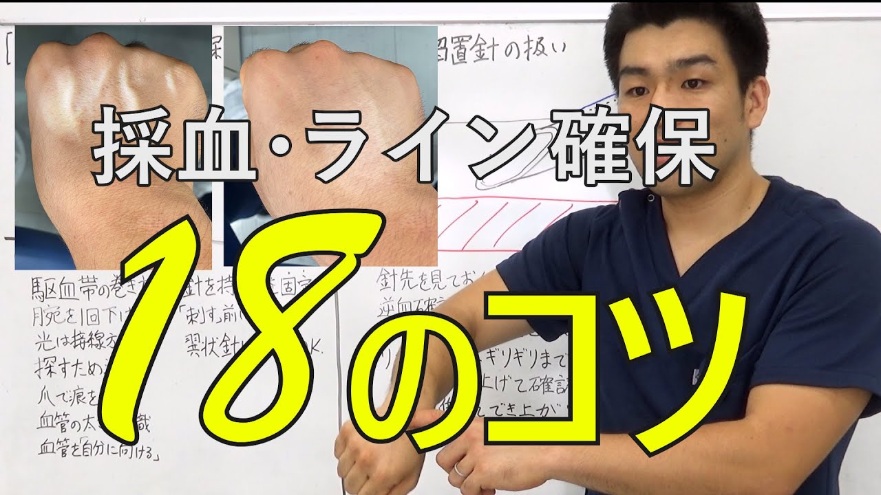 【注意：採血動画あり】採血、ライン確保のコツ　2021/6公開