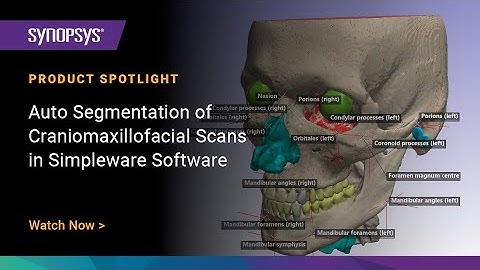 Auto Segmentation of Craniomaxillofacial Scans in Simpleware Software