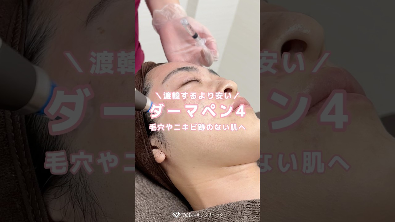 ダーマペン4