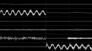 nerve agent beach party remix (UltraBox)
a halfassed remix of a tune remix made by @64abstract https://www.youtube.com/watch?v=VKcE2JR2KPo
which was based off @FLDEs tia tune Nerve Agent Beach Party https://www.youtube.com/watch?v=iE1LTlcTyGE
saw lead melody ripped off from δ:for the delta nerve agent beach party remix (UltraBox)