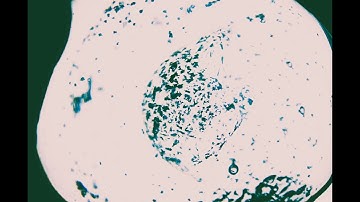 NEUTRALIZING PATHOGENS IN THE BRAIN | SCALAR ENERGY FIELD