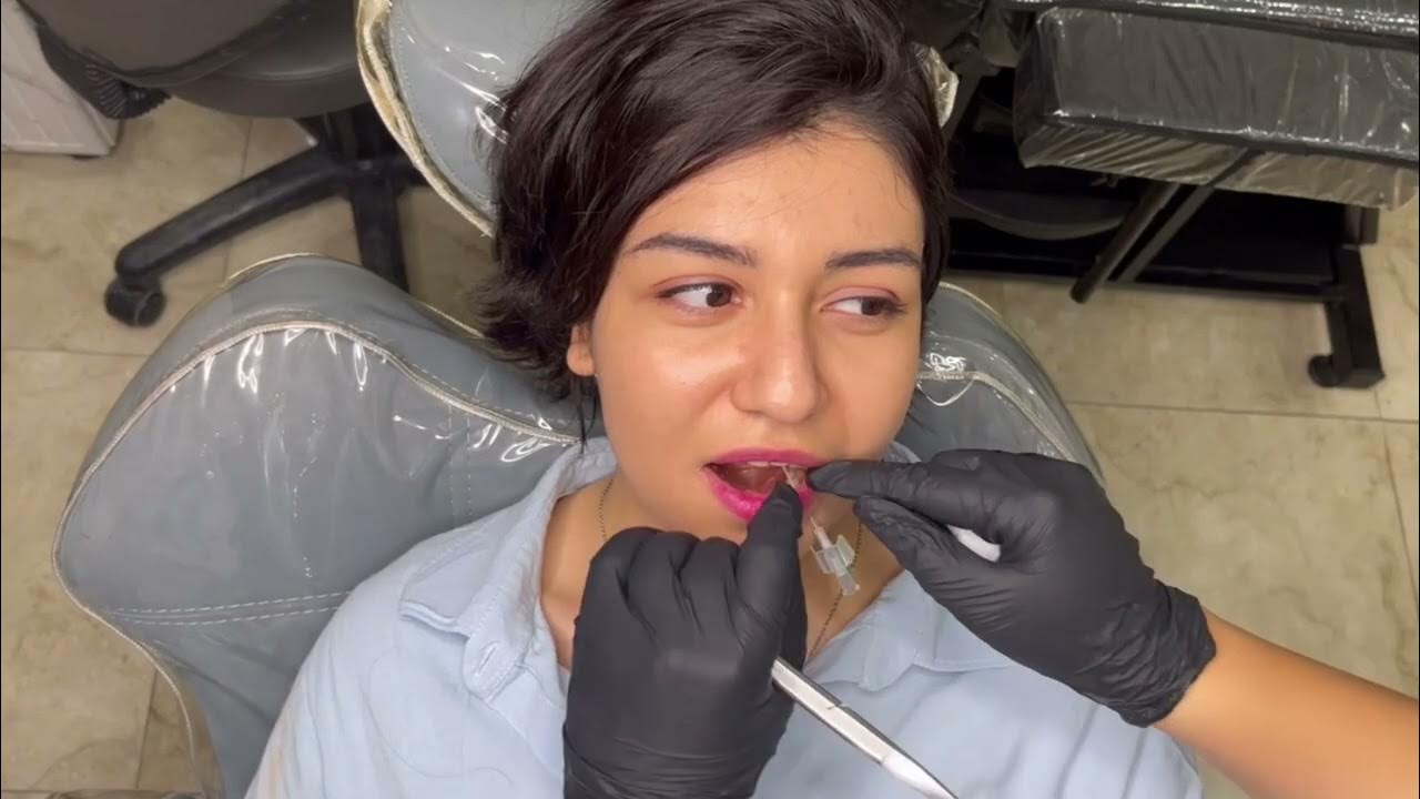 How to lip Piercing YouTube