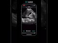 How to Freeze and Unfreeze Ultrasound Images with Exo Iris®