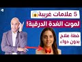 أخطر 5 أعراض لكسل الغدة الدرقية يجب أن تعرفها! الحل بلا دواء
