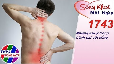 Những lưu ý trong bệnh gai cột sống | Sống khỏe mỗi ngày - Kỳ 1743