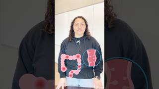 Colorectal Cancer Screening Options