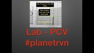 #planetrvn - How to prepare and read a PCV