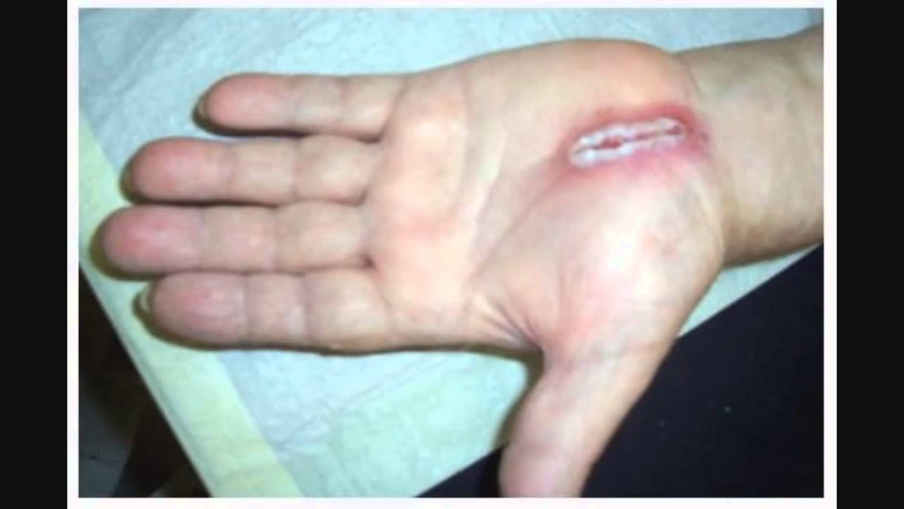 GRAVE Réfexion Jitter Click [FR] YouTube