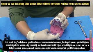 Jb-Tray Kullanım İpuçları Dentech Medikal