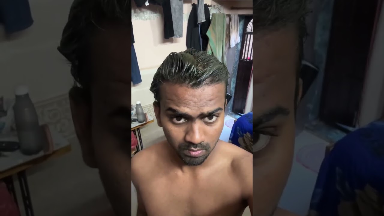 HAIR COLOUR AFTER HAIR TRANSPLANT 