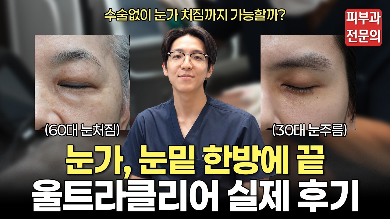눈가처짐, 눈밑주름 고민 끝! 울트라클리어로 한번에 해결!ㅣ울트라클리어, 리투오 파인, 눈밑꺼짐, 눈가주름, 잔주름, 오가나셀 성수, 성수 피부과, 뚝섬 피부과, 성동구 피부과