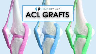 What are the different ACL Grafts? | Which one is best? Patella vs Hamstring