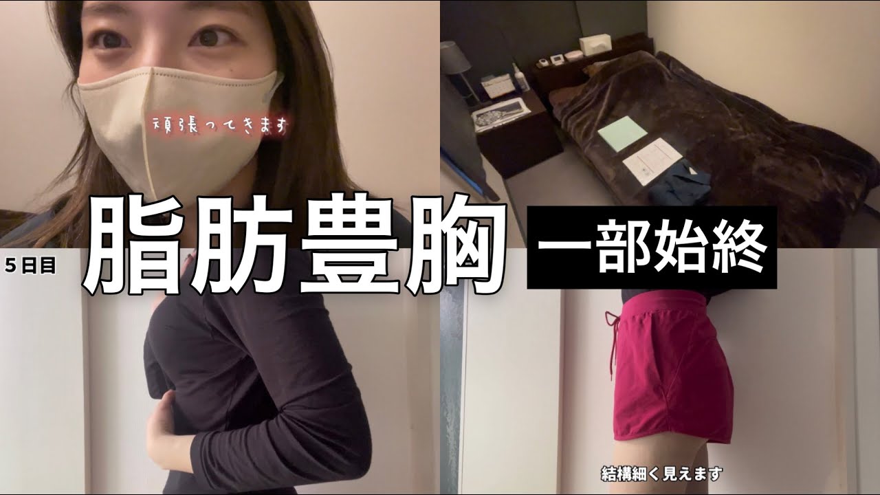 【閲覧注意】緊張してオールで挑んだ脂肪豊胸の一部始終をお見せします