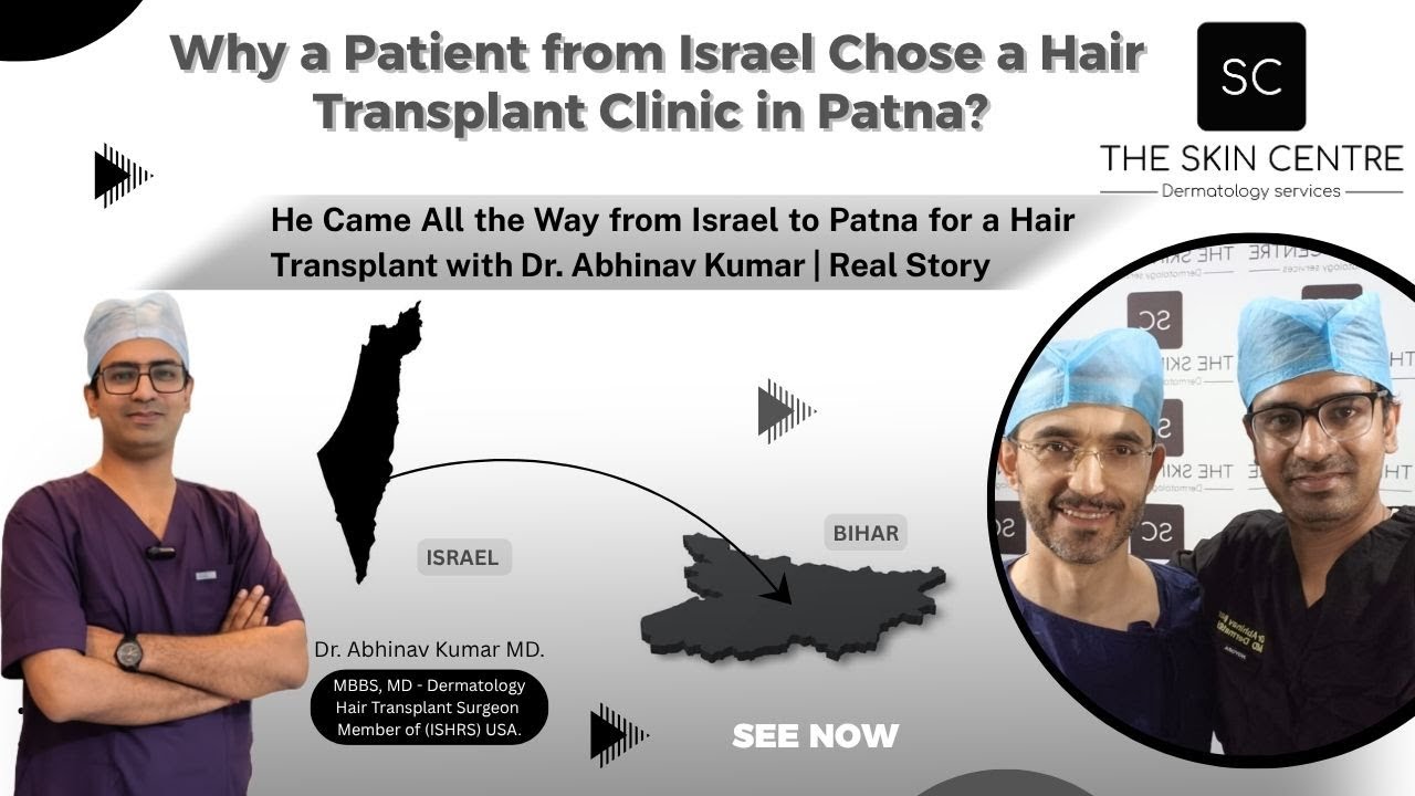 Пересадка волос в Индии: израильский пациент едет в Патну за результатами мирового класса. Автор:...