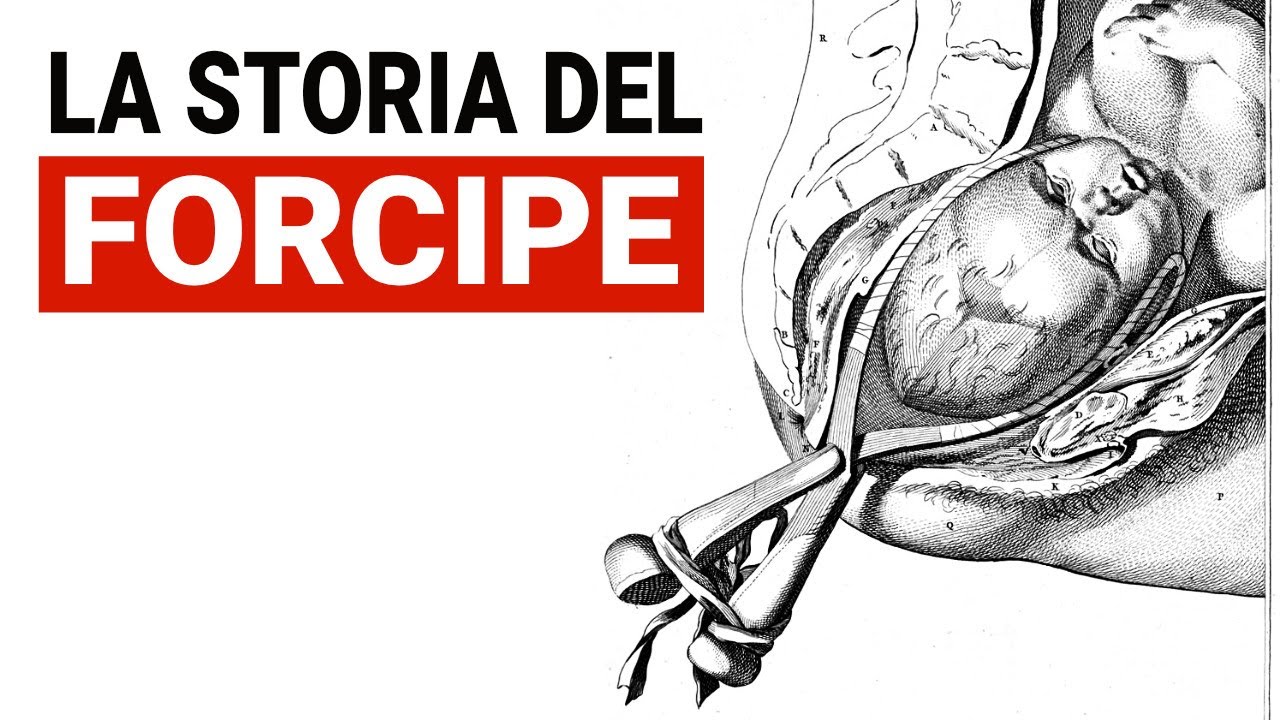 Il FORCIPE: SALVAVITA per Madri e Neonati del Passato