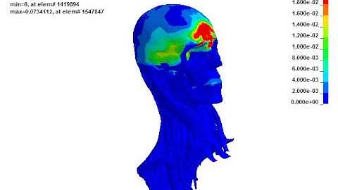 Human skull stresses due to horizontal impact