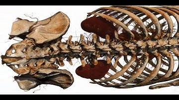 Human CT Scan rendered and visualized by ORS Visual Pro