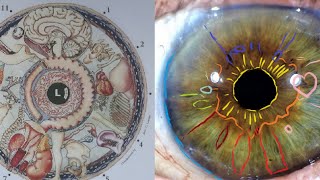 Iridology Lesson - Longevity as Seen in the Iris, Anemia Ring, Chronic Lymphatic Congestion, Sulphur