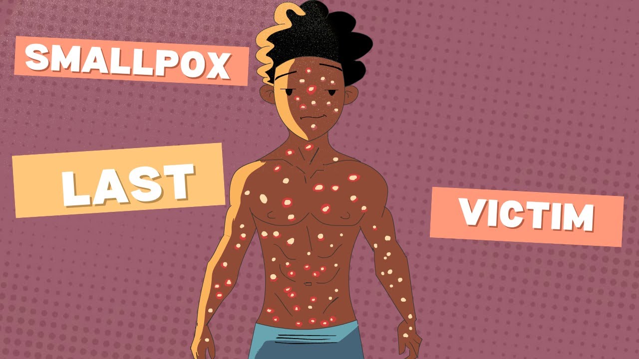 The Last Smallpox Survivor - YouTube