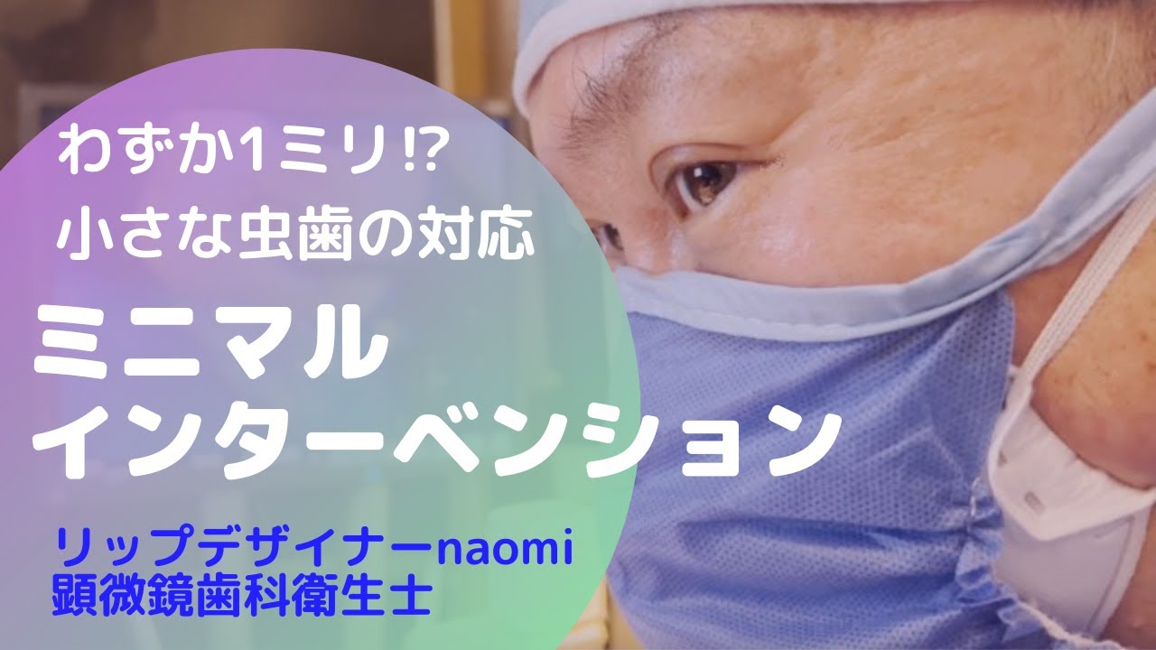 極力削らない虫歯の治療 – 東京・マイクロCTスキャンと顕微鏡歯科治療