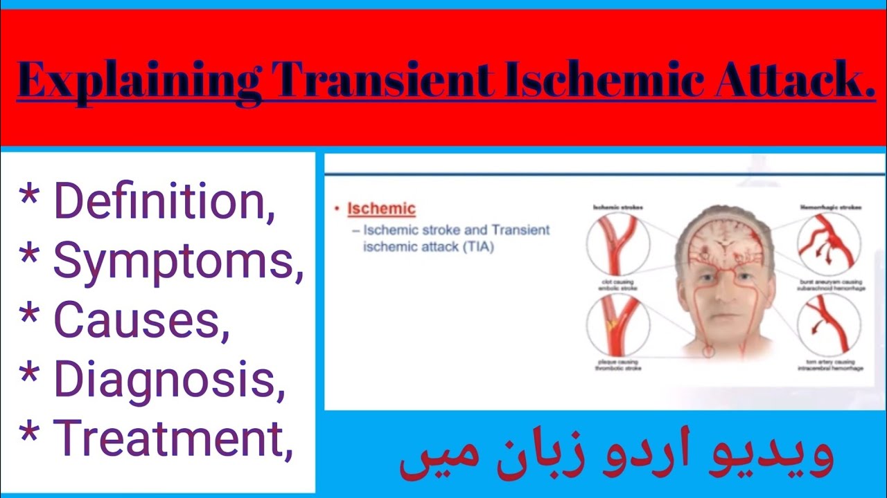 Explain the Transient Ischemic Attack|| What is Mini Attack|Brain Stroke Kia| Yaseen Health science|