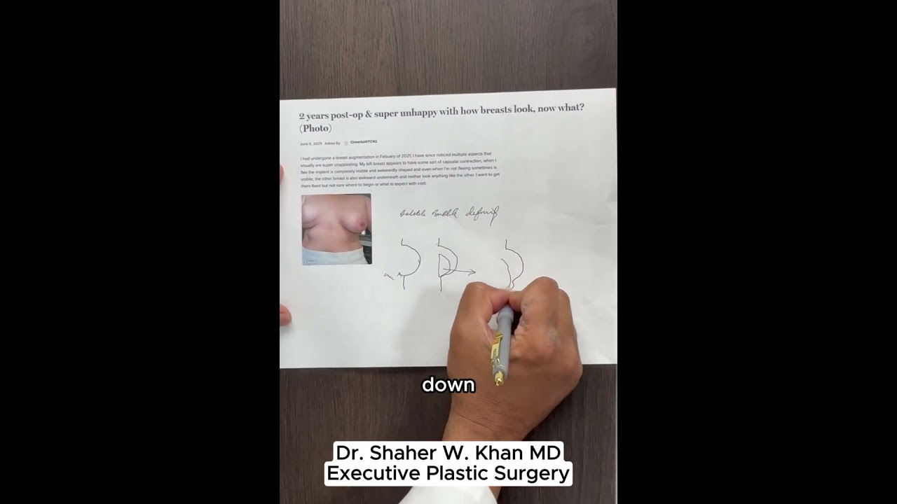 Why do I have a double bubble deformity?