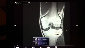 MobileMIM iPad radiology DICOM image viewer