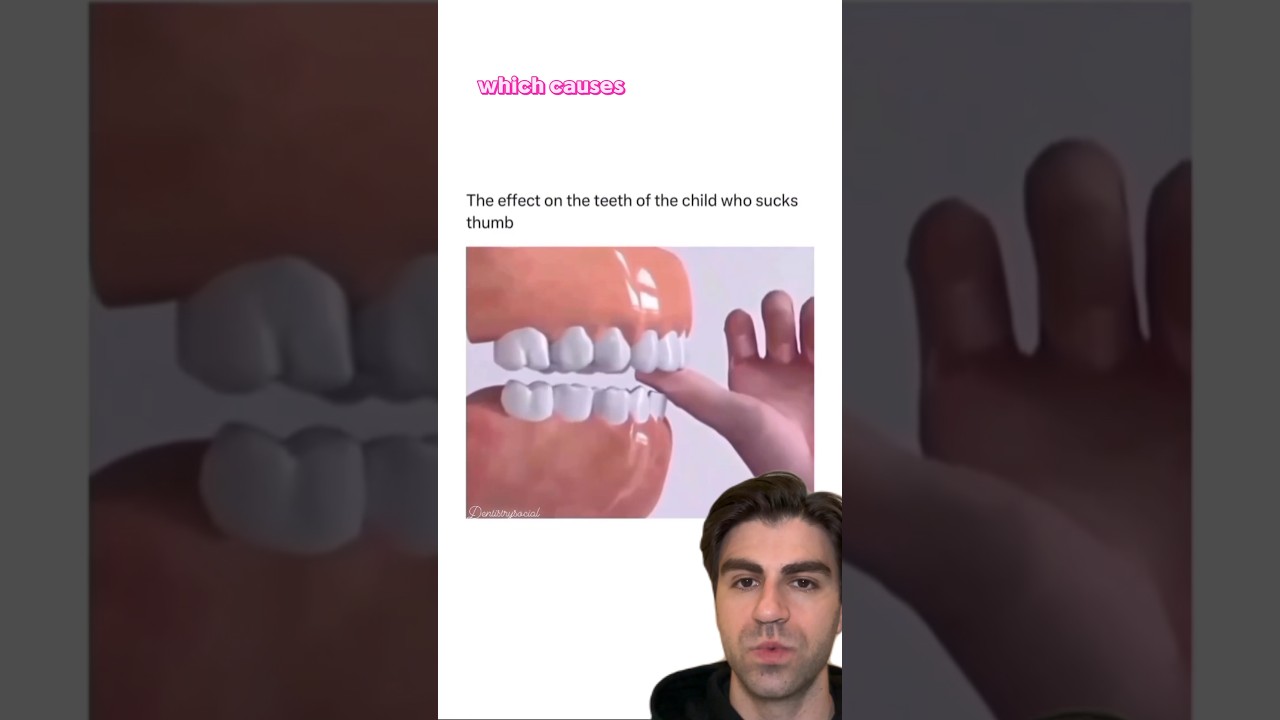 Thumb Sucking DESTROYS Your Teeth?