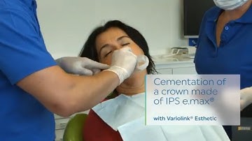 Variolink® Esthetic - Cementation of a crown made of IPS e.max® | EN | Ivoclar