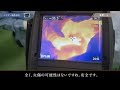 アキーセル脂肪吸引、ベイザー脂肪吸引に火傷の心配はあるのか?温度を比較 #3