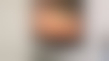 Phẫu Thuật Nội Soi Cắt Túi Mật