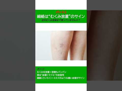 細絡は ”むくみ放置”のサイン ・足のむくみ翌朝まで残っていませんか?
