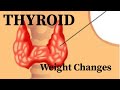 How thyroid changes weight