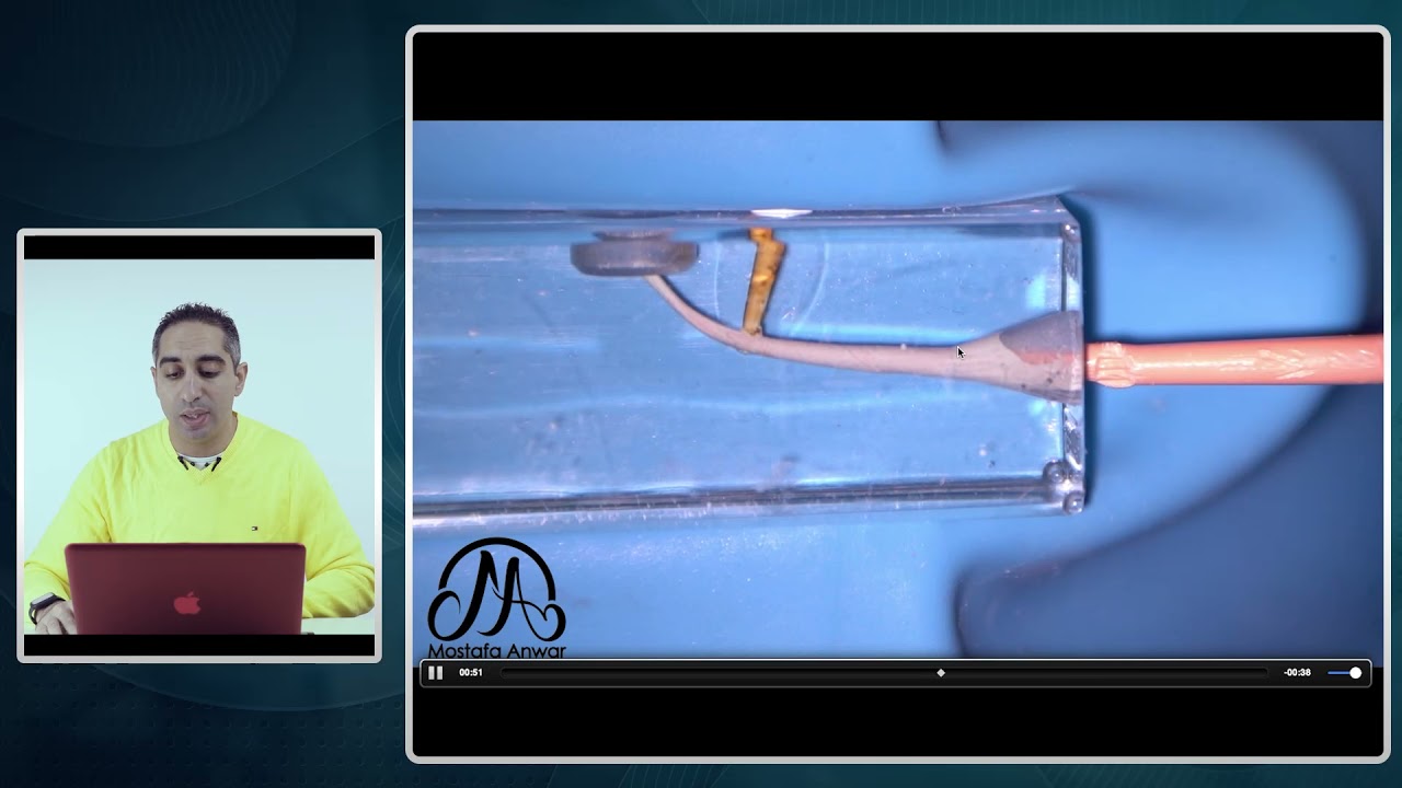 How to Apply BioCeramic Sealer Easily during Obturation of Root Canals