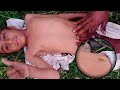 HIGHLY RECOMMENDED ASMR || BELLY BUTTON MASSAGE THERAPY FOR 24/ HOUR SLEEP!
