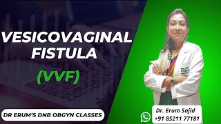 Vesicovaginal Fistula (VVF) | DNB Theory Class | DNB OBGYN coaching All India chapter- Dr Erum