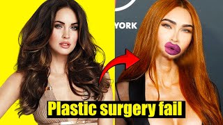 Famous Celebrity Plastic Surgery Disasters You’d Never Recognize Today Net Worth