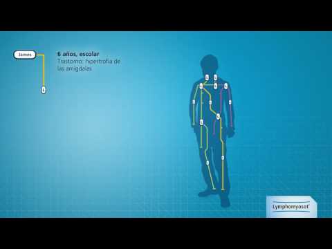 Video: Lymfomyosotti Adenoideilla - Käyttöaiheet, Edut Ja Haitat
