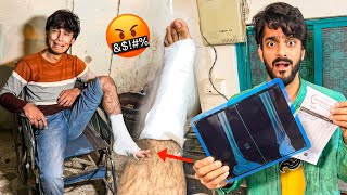 Munne Ki Bones Toot Gai   Plaster Karana Para  Mishkat Khan Vlog 