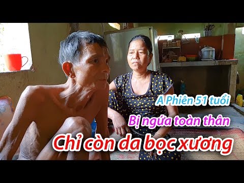 Video Rớt nước mắt gặp lại anh Phiên người cơ tu chỉ còn da... - youtube