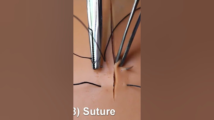 188.Figure of 8 suture #technique of suturing #dental procedure  #dentist #surgeryeducation #stitch